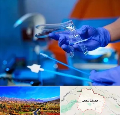 تست پاپ اسمیر در خراسان شمالی