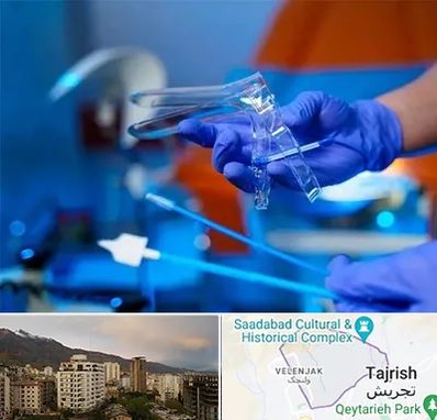 تست پاپ اسمیر در زعفرانیه 