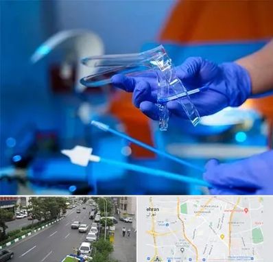 تست پاپ اسمیر در ستارخان 