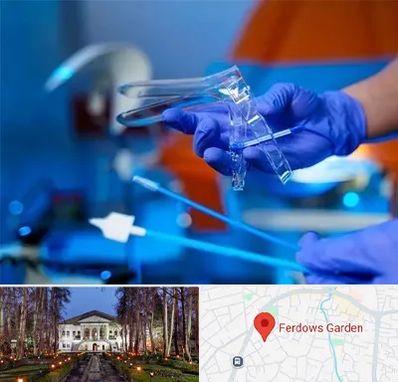 تست پاپ اسمیر در باغ فردوس