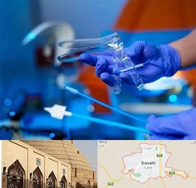 تست پاپ اسمیر در ساوه