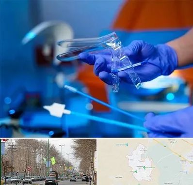 تست پاپ اسمیر در نظرآباد کرج 