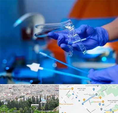 تست پاپ اسمیر در محلاتی شیراز