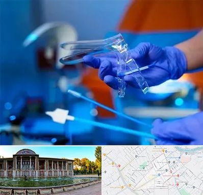 تست پاپ اسمیر در عفیف آباد شیراز