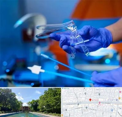 تست پاپ اسمیر در هشت بهشت اصفهان