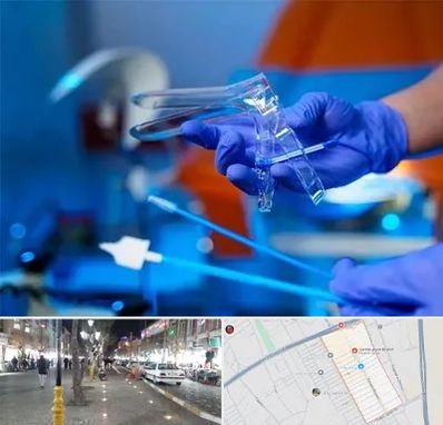 تست پاپ اسمیر در باغ فیض اسلامشهر