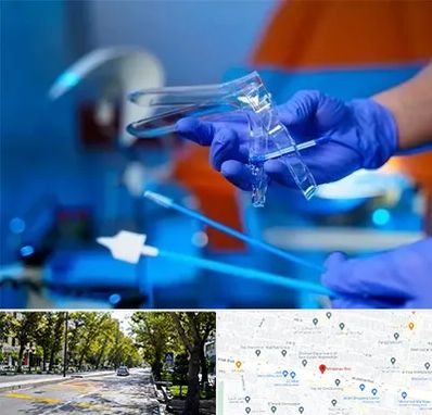 تست پاپ اسمیر در میرداماد 