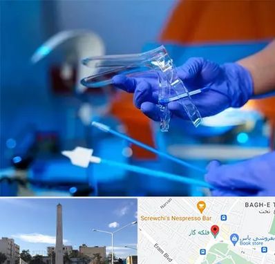 تست پاپ اسمیر در فلکه گاز شیراز