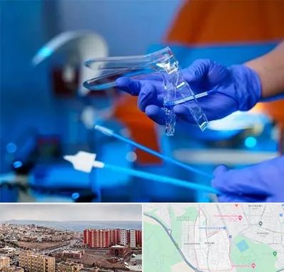 تست پاپ اسمیر در سهند تبریز