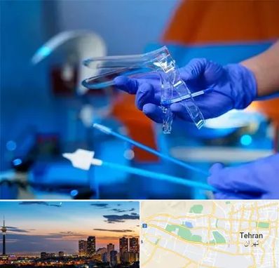 تست پاپ اسمیر در غرب تهران 