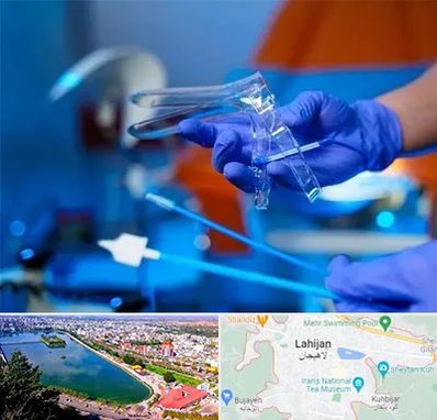 تست پاپ اسمیر در لاهیجان