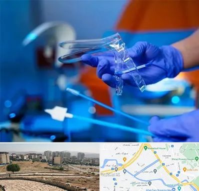 تست پاپ اسمیر در کوی وحدت شیراز