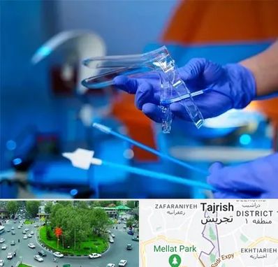 تست پاپ اسمیر در تجریش 