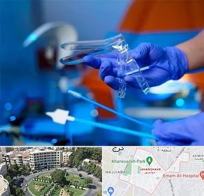 تست پاپ اسمیر در جهانشهر کرج 