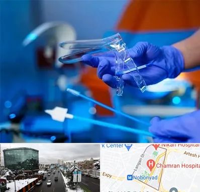 تست پاپ اسمیر در اقدسیه 