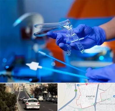 تست پاپ اسمیر در خطیب تبریز