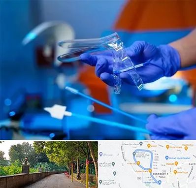 تست پاپ اسمیر در بلوار گیلان رشت