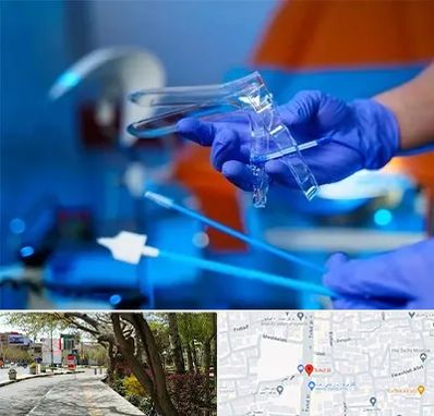 تست پاپ اسمیر در خیابان توحید اصفهان