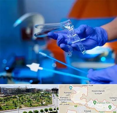 تست پاپ اسمیر در پردیس