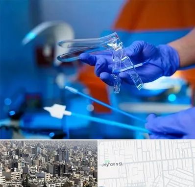 تست پاپ اسمیر در جیحون