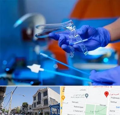 تست پاپ اسمیر در افسریه 