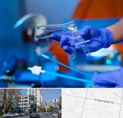 تست پاپ اسمیر در کامرانیه