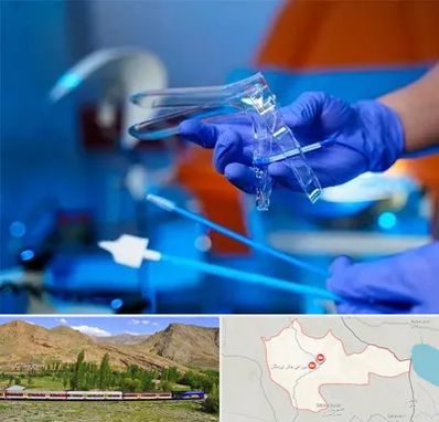 تست پاپ اسمیر در خاش