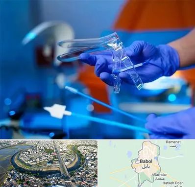 تست پاپ اسمیر در بابل