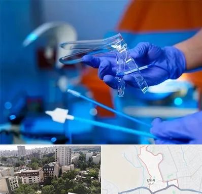 تست پاپ اسمیر در اوین