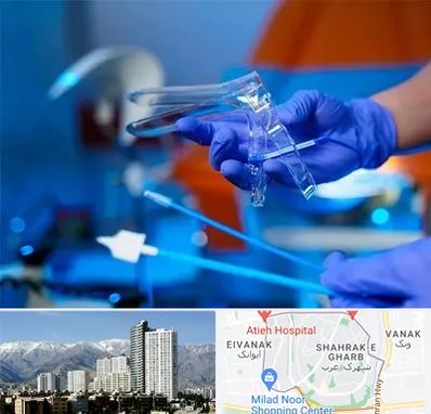 تست پاپ اسمیر در شهرک غرب 