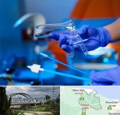 تست پاپ اسمیر در چالوس