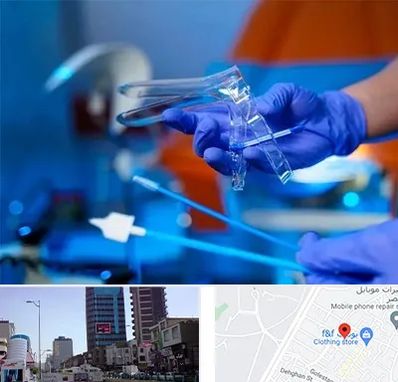 تست پاپ اسمیر در چهارراه طالقانی کرج