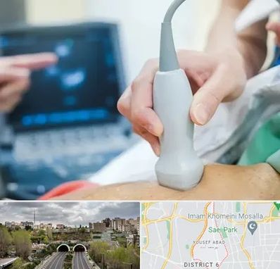 اکو قلب شبانه روزی در یوسف آباد 