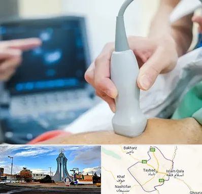 اکو قلب شبانه روزی در تایباد