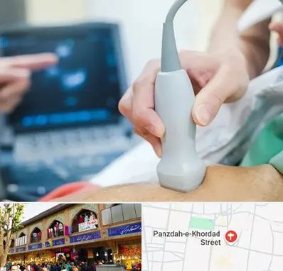 اکو قلب شبانه روزی در 15 خرداد