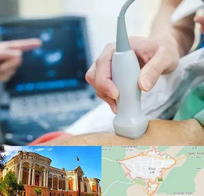 اکو قلب شبانه روزی در خوی