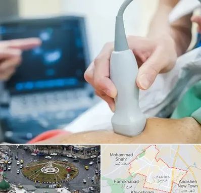 اکو قلب شبانه روزی در فردیس کرج 