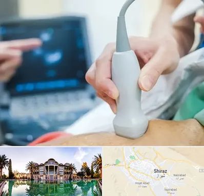 اکو قلب شبانه روزی در شیراز