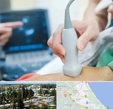 اکو قلب شبانه روزی در رودسر