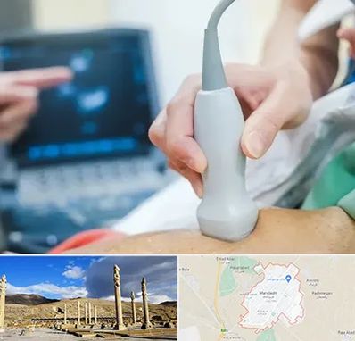 اکو قلب شبانه روزی در مرودشت