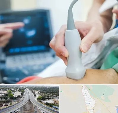 اکو قلب شبانه روزی در اندیمشک