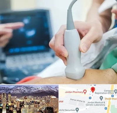 اکو قلب شبانه روزی در جردن 