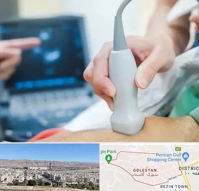 اکو قلب شبانه روزی در شهرک گلستان شیراز