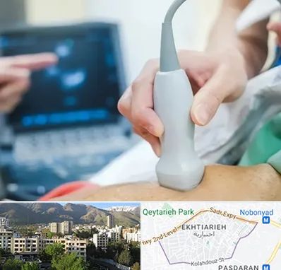 اکو قلب شبانه روزی در اختیاریه