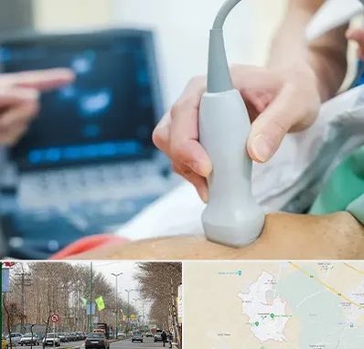 اکو قلب شبانه روزی در نظرآباد کرج 