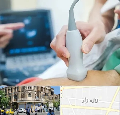 اکو قلب شبانه روزی در لاله زار