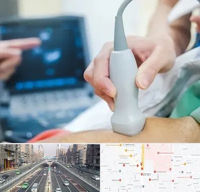 اکو قلب شبانه روزی در توحید 