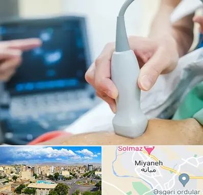 اکو قلب شبانه روزی در میانه