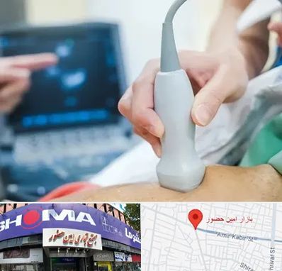 اکو قلب شبانه روزی در امین حضور