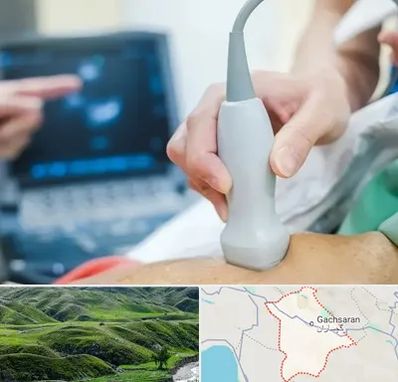 اکو قلب شبانه روزی در گچساران